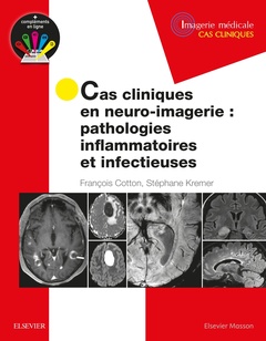 Couverture de l’ouvrage Cas cliniques en neuro-imagerie : pathologies inflammatoires et infectieuses