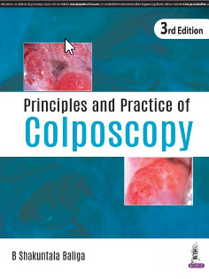 Couverture de l’ouvrage Principles and Practice of Colposcopy