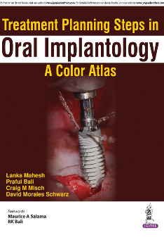 Couverture de l’ouvrage Treatment Planning Steps in Oral Implantology