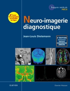 Couverture de l’ouvrage Neuro-imagerie diagnostique