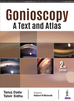 Couverture de l’ouvrage Gonioscopy: A Text and Atlas