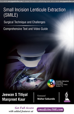 Couverture de l’ouvrage Small Incision Lenticule Extraction (SMILE): Surgical Technique and Challenges