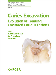 Couverture de l’ouvrage Caries Excavation: Evolution of Treating Cavitated Carious Lesions