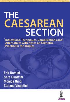 Couverture de l’ouvrage The Caesarean Section
