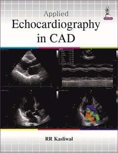 Cover of the book Applied Echocardiography in Coronary Artery Disease