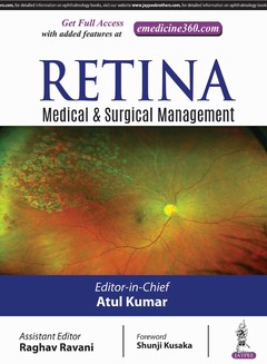 Cover of the book Retina