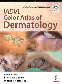Couverture de l’ouvrage IADVL Color Atlas of Dermatology