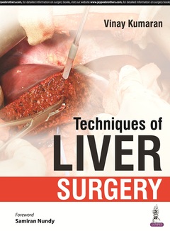 Couverture de l’ouvrage Techniques of Liver Surgery