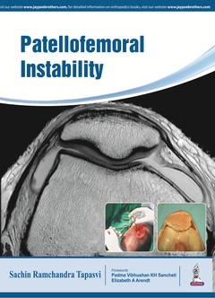 Cover of the book Patellofemoral Instability
