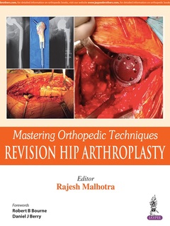 Couverture de l’ouvrage Mastering Orthopedic Techniques: Revision Total Hip Arthroplasty