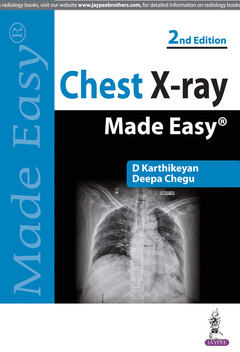 Cover of the book Chest X-ray Made Easy