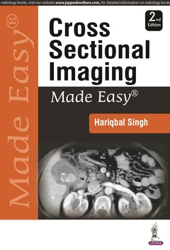 Couverture de l’ouvrage Cross Sectional Imaging Made Easy 