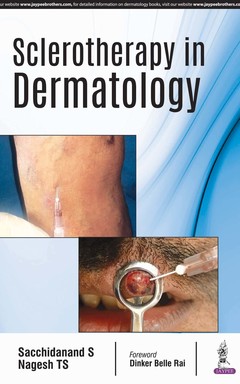 Couverture de l’ouvrage Sclerotherapy in Dermatology
