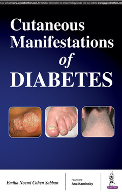 Couverture de l’ouvrage Cutaneous Manifestations of Diabetes