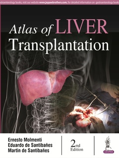 Couverture de l’ouvrage Atlas of Liver Transplantation 