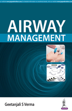 Couverture de l’ouvrage Airway Management