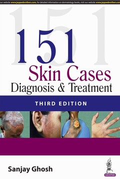 Cover of the book 151 Skin Cases