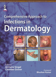 Couverture de l’ouvrage Comprehensive Approach to Infections in Dermatology