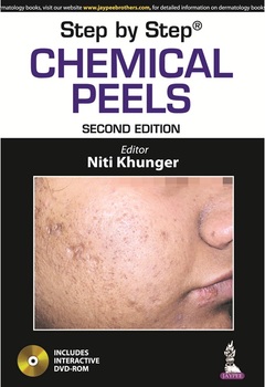 Cover of the book Step by Step: Chemical Peels