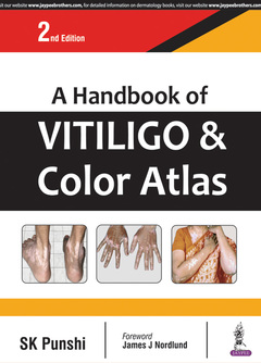 Couverture de l’ouvrage A Handbook of Vitiligo & Color Atlas