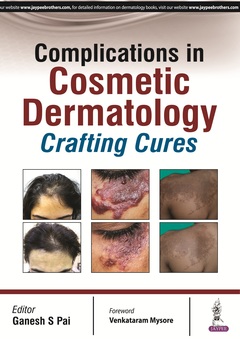 Couverture de l’ouvrage Complications in Cosmetic Dermatology