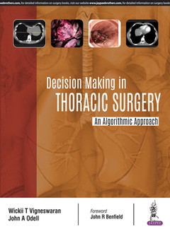 Couverture de l’ouvrage Decision Making in Thoracic Surgery