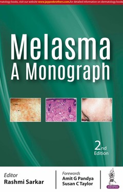 Couverture de l’ouvrage Melasma: A Monograph