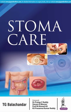 Couverture de l’ouvrage Stoma Care