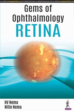 Couverture de l’ouvrage Gems of Ophthalmology: Retina