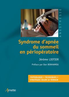 Cover of the book Syndrome d'apnée du sommeil en périopératoire