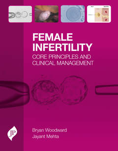 Couverture de l’ouvrage Female Infertility