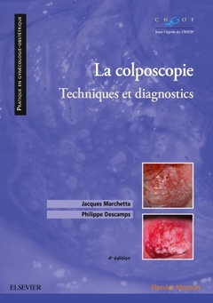 Cover of the book La colposcopie