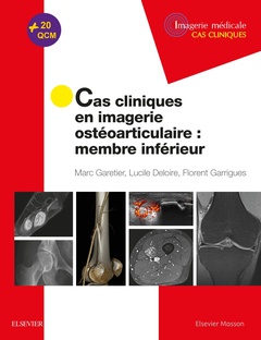 Cover of the book Cas cliniques en imagerie ostéoarticulaire : membre inférieur