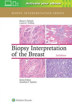 Cover of the book Biopsy Interpretation of the Breast (3rd Ed.) (inc. e-book)