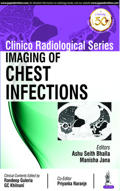 Couverture de l’ouvrage Clinico Radiological Series: Imaging of Chest Infections