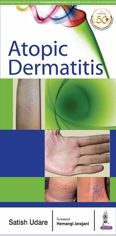 Couverture de l’ouvrage Atopic Dermatitis