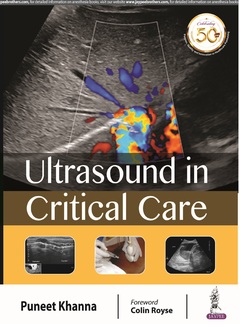 Cover of the book Ultrasound in Critical Care