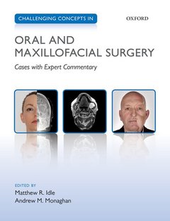Cover of the book Challenging Concepts in Oral and Maxillofacial Surgery