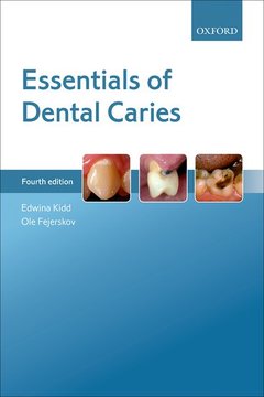 Couverture de l’ouvrage Essentials of Dental Caries