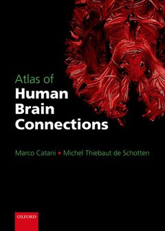 Couverture de l’ouvrage Atlas of Human Brain Connections