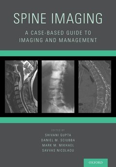 Couverture de l’ouvrage Spine Imaging