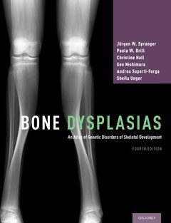 Couverture de l’ouvrage Bone Dysplasias