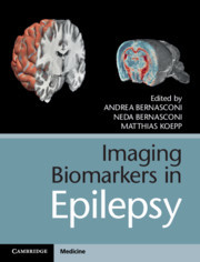 Couverture de l’ouvrage Imaging Biomarkers in Epilepsy