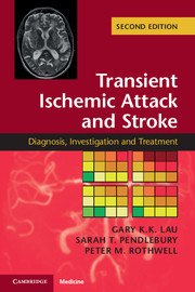 Couverture de l’ouvrage Transient Ischemic Attack and Stroke