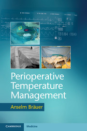 Couverture de l’ouvrage Perioperative Temperature Management
