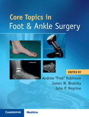 Couverture de l’ouvrage Core Topics in Foot and Ankle Surgery