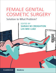 Couverture de l’ouvrage Female Genital Cosmetic Surgery