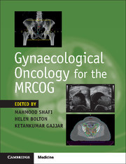 Couverture de l’ouvrage Gynaecological Oncology for the MRCOG