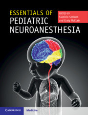 Couverture de l’ouvrage Essentials of Pediatric Neuroanesthesia