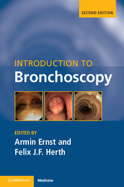 Couverture de l’ouvrage Introduction to Bronchoscopy